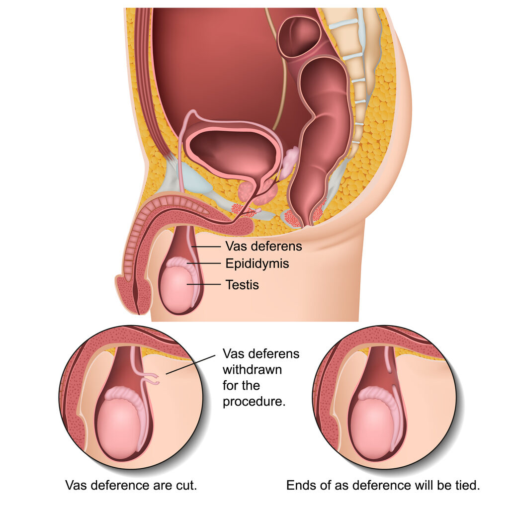 Illustration of male reproductive system. specific parts are labeled: vas deference, epididymis, testes.